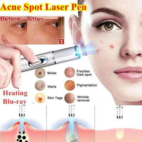 LAOZIK All-in-One Laser Eraser Pen