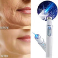 LAOZIK All-in-One Laser Eraser Pen